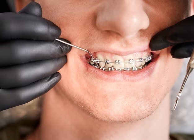 Orthodontics
