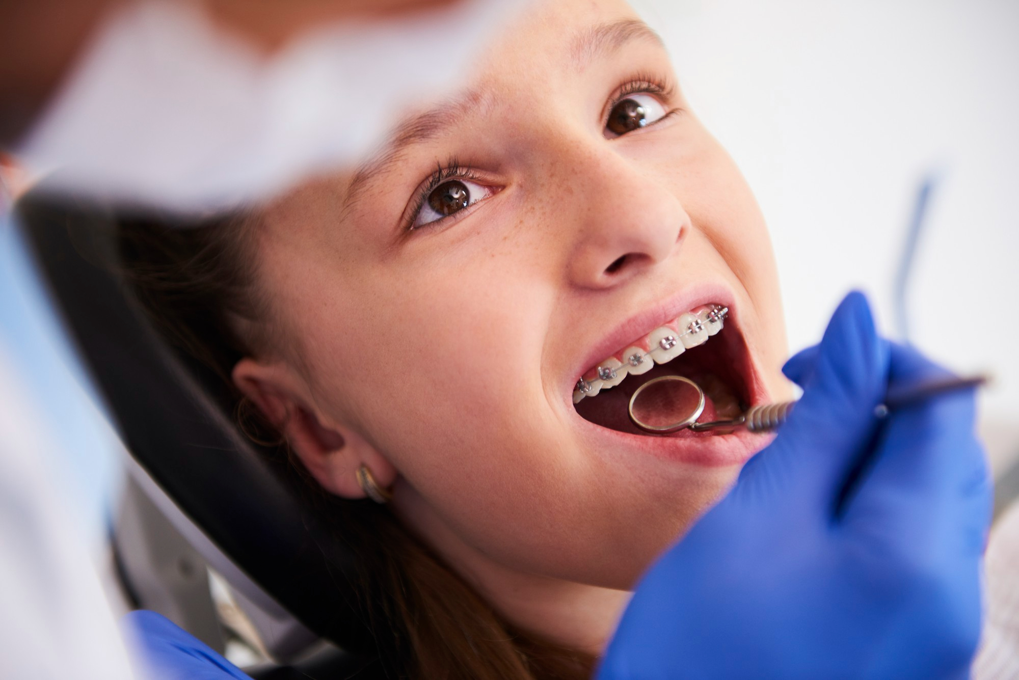 The Science of Smiles: Understanding Pediatric Orthodontics