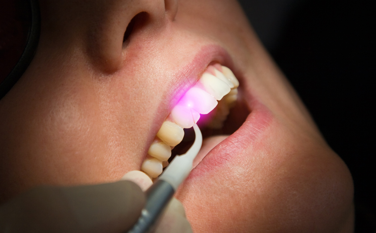 Laser treatment
