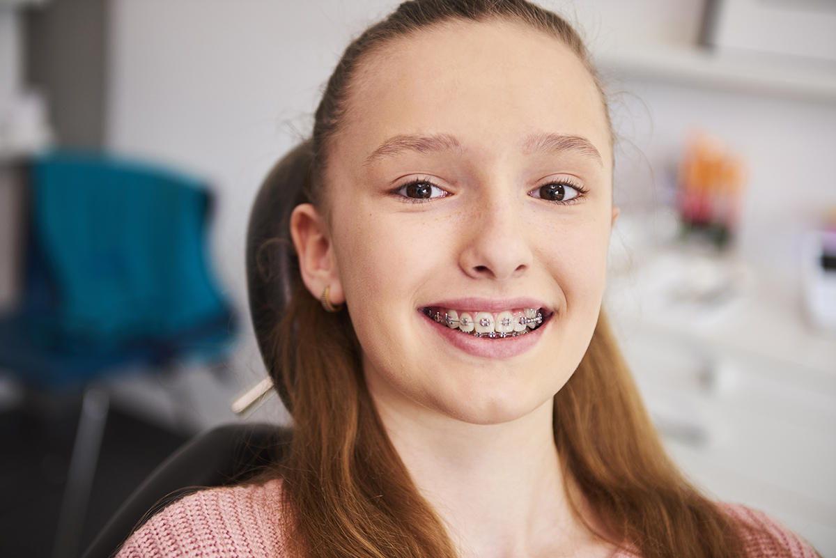 Metal braces